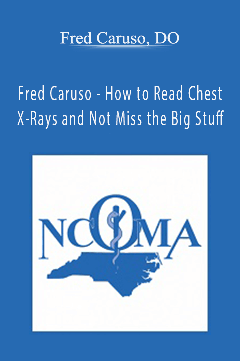 Fred Caruso - How to Read Chest X-Rays and Not Miss the Big Stuff - Fred Caruso, DO